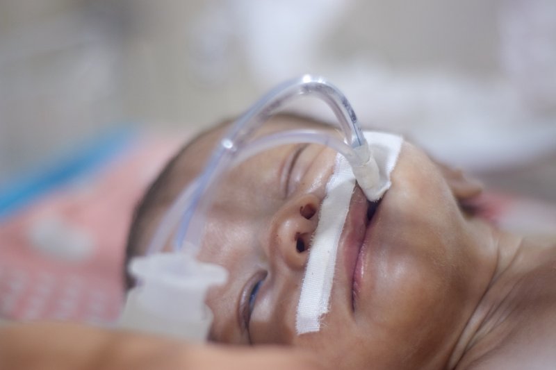 Close up image of a very young infant receiving medical support in a health care setting.